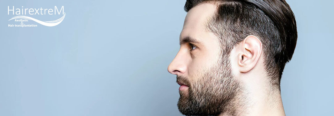 Combien de jours après la greffe de cheveux puis-je retourner au travail?