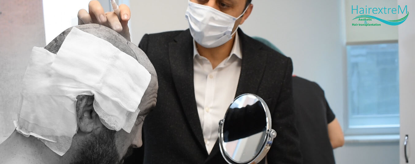 Les patients infectés par le VIH peuvent-ils avoir une greffe de cheveux?