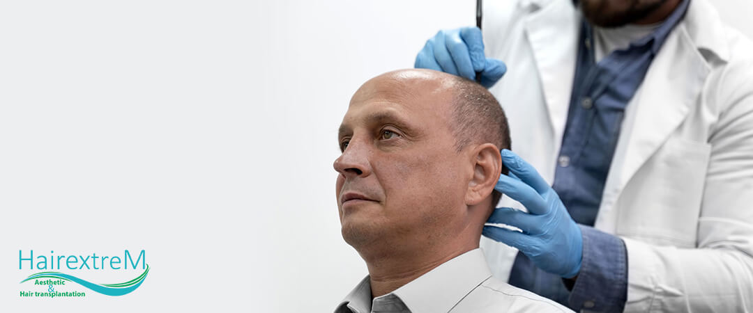 Où est le meilleur endroit au monde pour obtenir une greffe de cheveux?