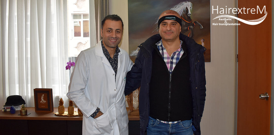 Préparation avant la greffe de cheveux