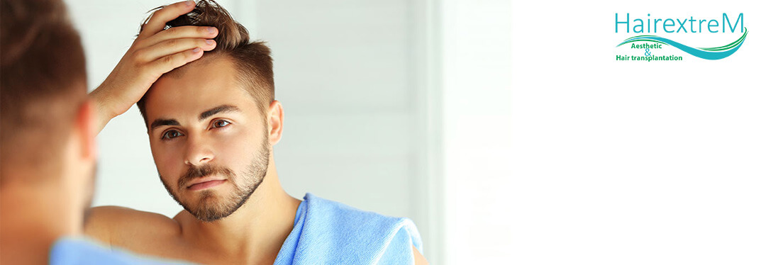 Qu’est-ce que l’Alopécie areata? Comment la traite-t-on?